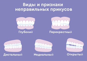 Стоматология Кристалл во Фрязино, стоматологическая клиника Кристалл во Фрязино