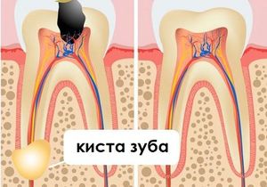 Стоматология Кристалл во Фрязино, стоматологическая клиника Кристалл во Фрязино